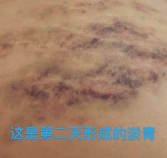 被吴京捧红后”反咬一口“，现实版的农夫与蛇，如今惨遭报应！