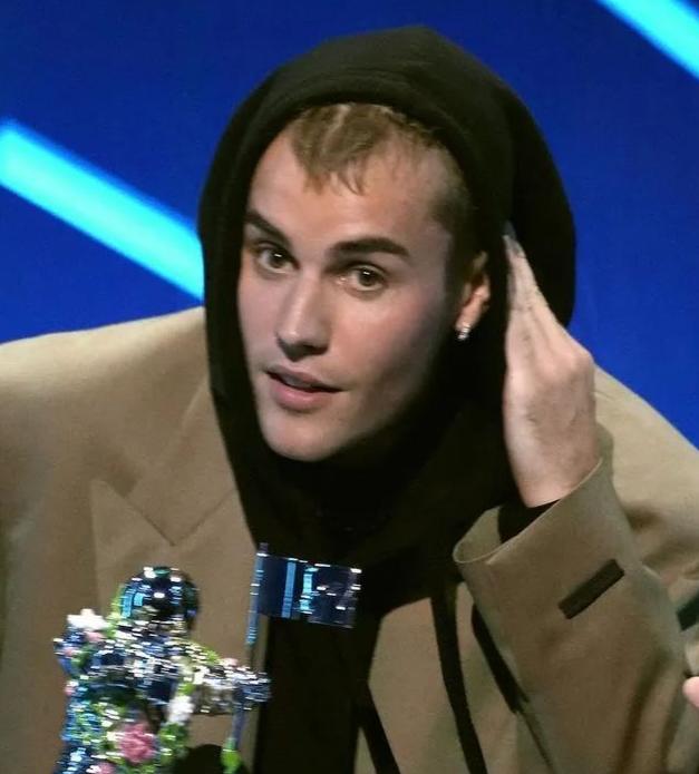 Justin Bieber 脂溢性脱发，有秃顶的前兆了…