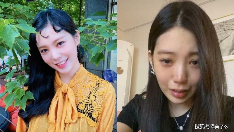 女星Lizzy意外后首露面，直播痛哭反被骂！