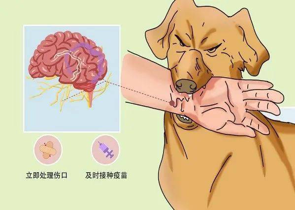 随后立即去正规医疗机构接种狂犬疫苗.