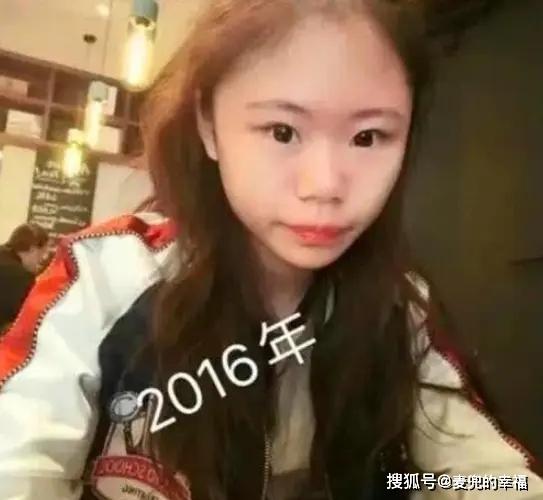 还记得花百万整容的13岁女孩吗？3年整了100次，如今前后判若两人