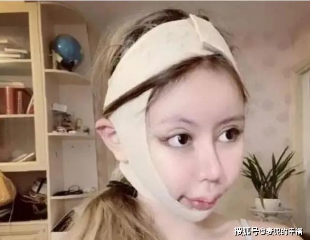 还记得花百万整容的13岁女孩吗？3年整了100次，如今前后判若两人