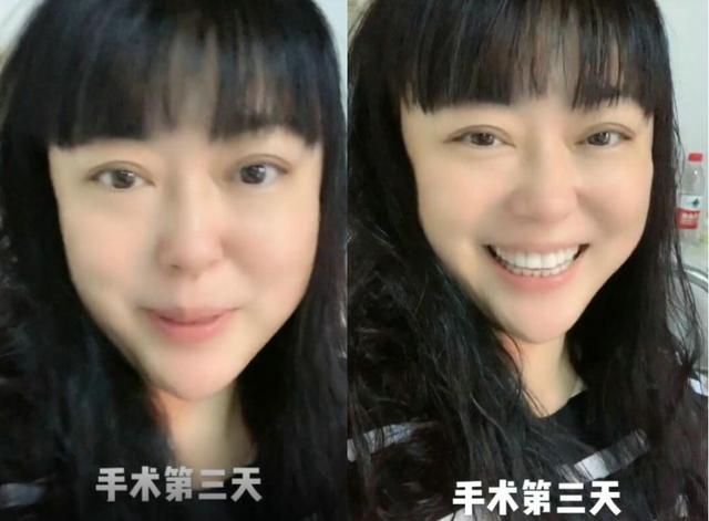 李菁菁自曝患癌，此前被500位导演联合封杀，三婚嫁小21岁小鲜肉