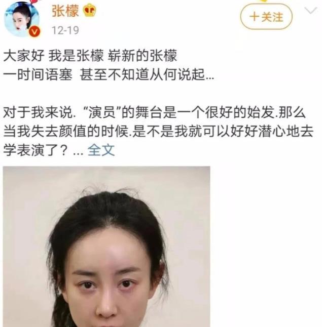 《美人心计》播出10年，9位美人差距很明显，戏外整容却毁容了