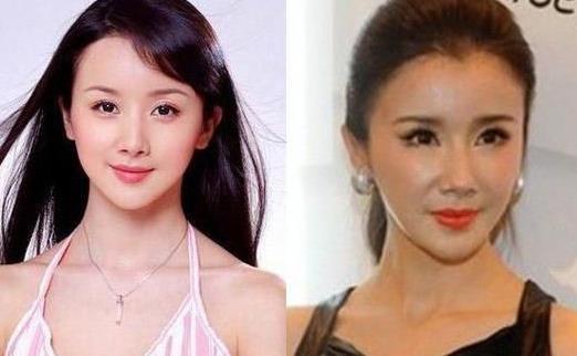 《美人心计》播出10年，9位美人差距很明显，戏外整容却毁容了