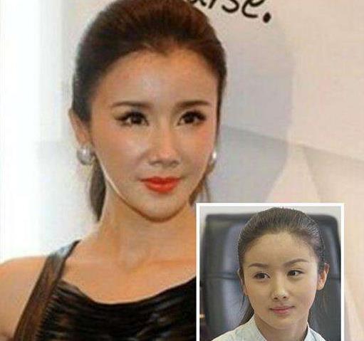 《美人心计》播出10年，9位美人差距很明显，戏外整容却毁容了