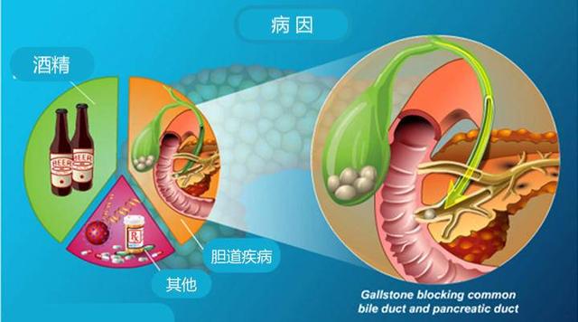 胰腺是人体消化系统的重要组，当他出现炎症后我们该如何治疗呢？