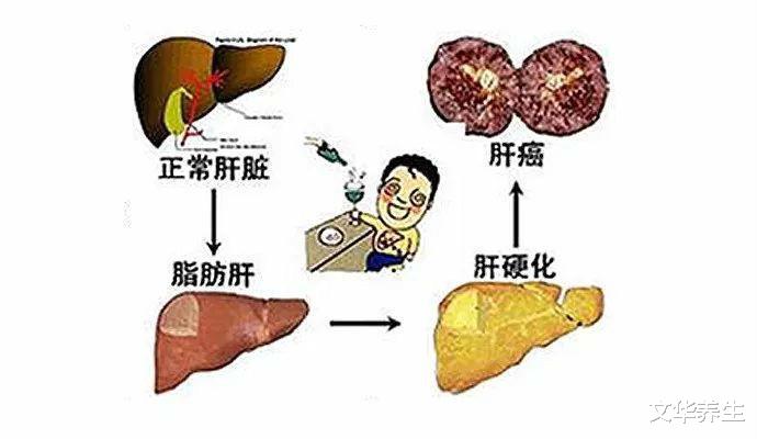 让运动为肝脏减减脂：要想人舒坦就要爱“肝”净