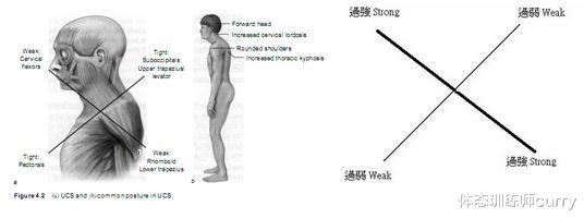 毁掉你健康的头前引，应该如何改善？这一套训练别错过