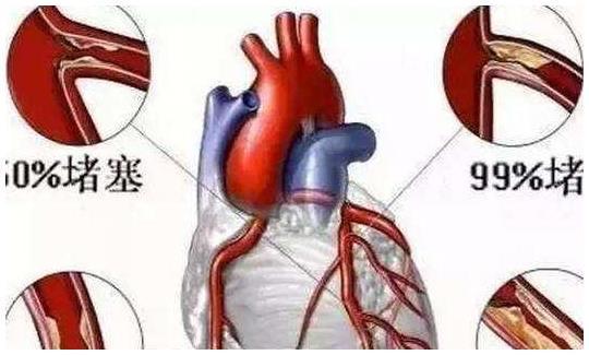 红薯是升血糖还是降血糖呢？糖尿病人可以吃吗？看完或许你就懂了