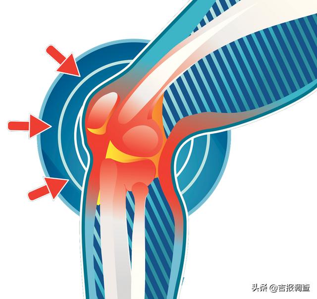 中医专家告诉你：这两种病90%的人都会混淆、用错药