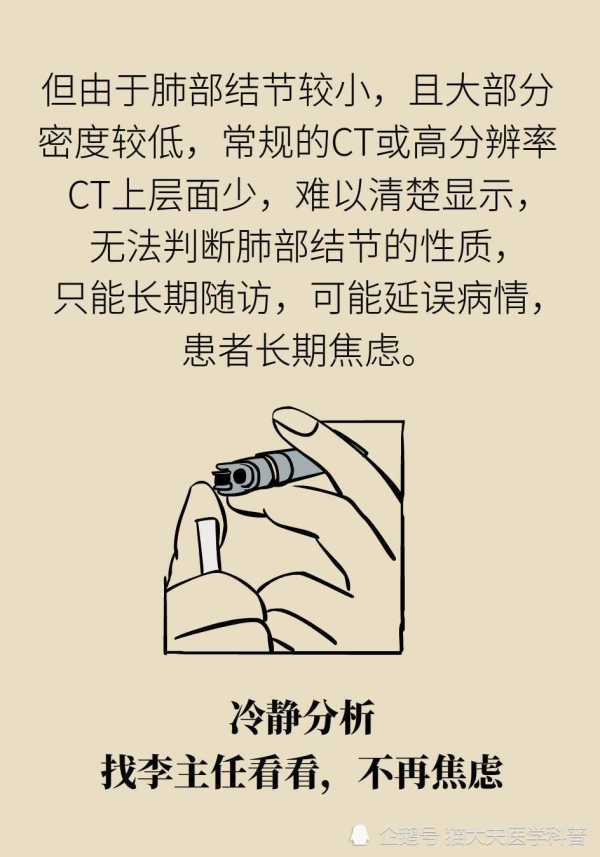 长了肺结节如何尽早确定手术还是观察？神奇的1024靶扫描了解一下