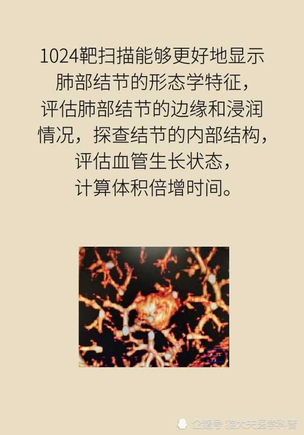 长了肺结节如何尽早确定手术还是观察？神奇的1024靶扫描了解一下