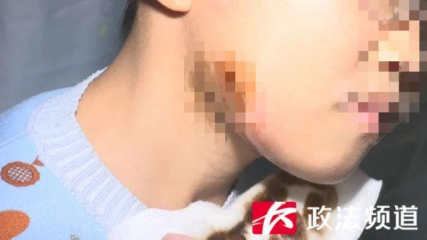 七岁男孩龋齿发炎导致患上败血症，医生提醒这些生活细节要注意