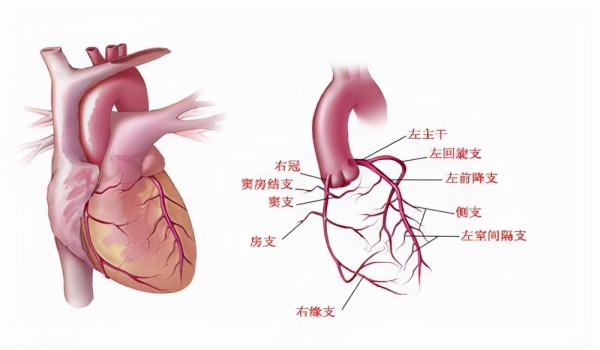 冠心病心绞痛、心梗、支架搭桥、心肌缺血！什么区别？一文说清！