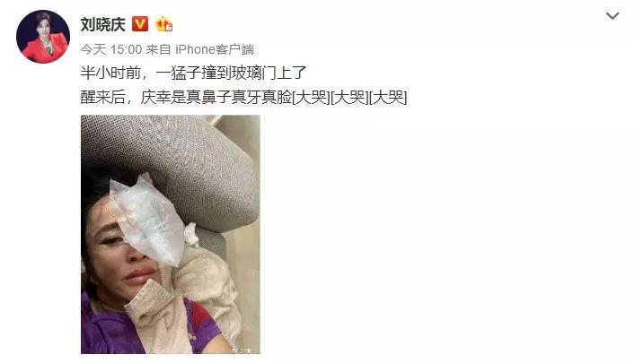 整容后的十大女星，有人吓跑观众，有人成网红，最后一个让人惋惜？