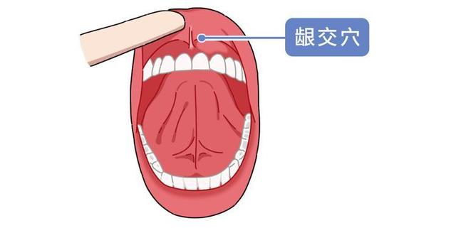 牙龈肿痛、口臭，找龈交穴来帮忙