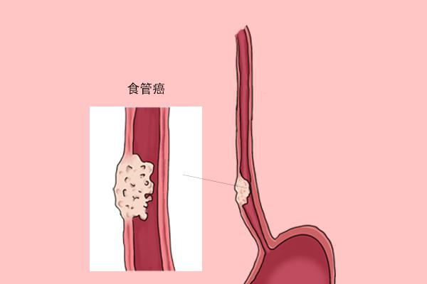 吃辣可以预防癌症？针对50万人的研究，颠覆你对辣椒的认知