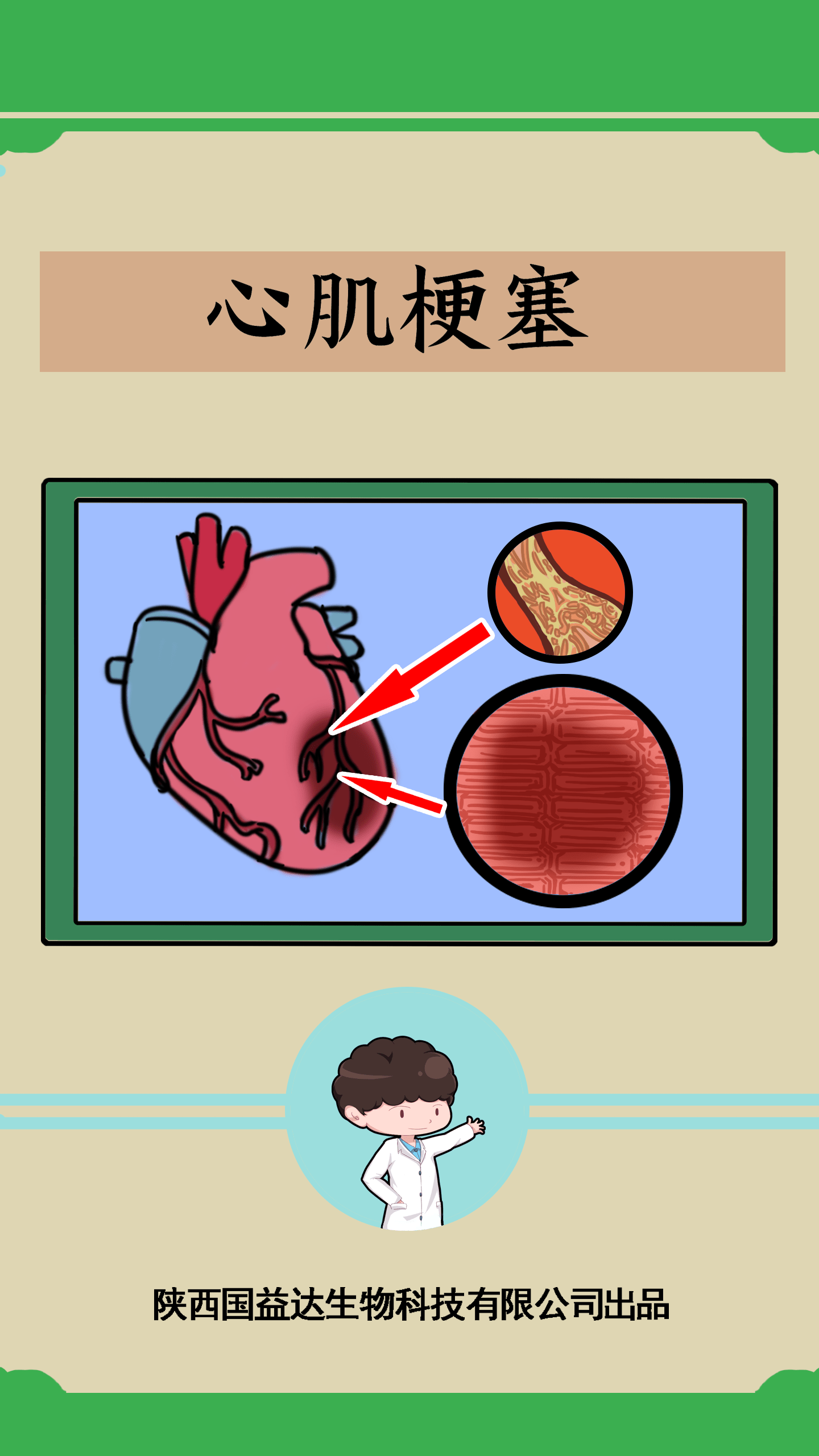 漫画一图读懂心肌梗塞