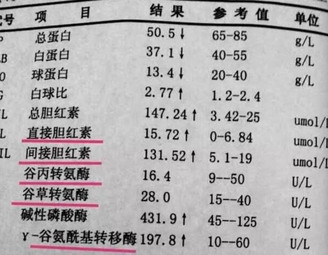 转氨酶偏高，不能吃南瓜吗？医生：想养肝，3种蔬菜请撤下饭桌