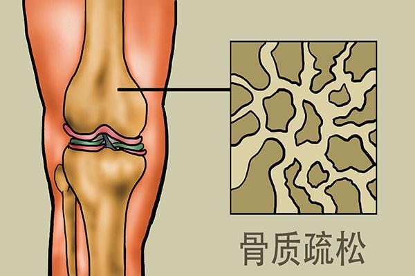 “筋长一寸，延寿十年”，靠谱吗？经常拉筋的人，身体如何了？