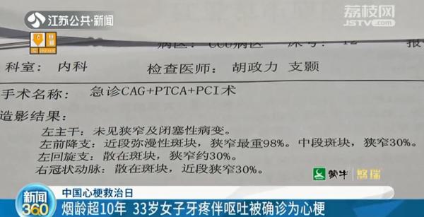 烟龄超10年 南京33岁女子牙疼伴呕吐被确诊为心梗