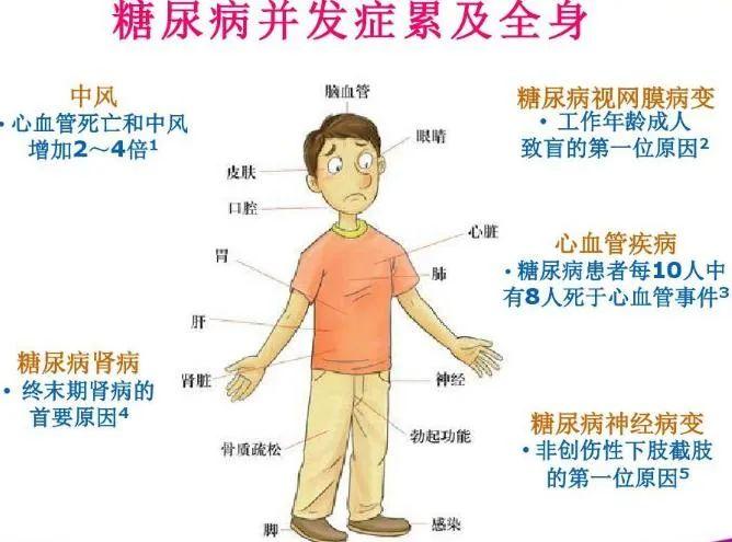 糖友不想吃药，靠饮食运动控糖，血糖飙升到13.6！医生：这种做法很危险！