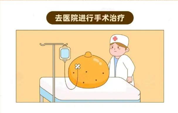 乳头凹进去了怎么办？会是乳腺癌吗？干货！