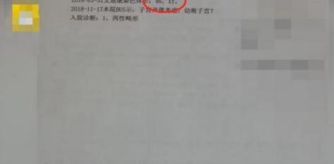 女子婚后治不孕，检查竟是“男儿身”，网友：求老公心理阴影面积