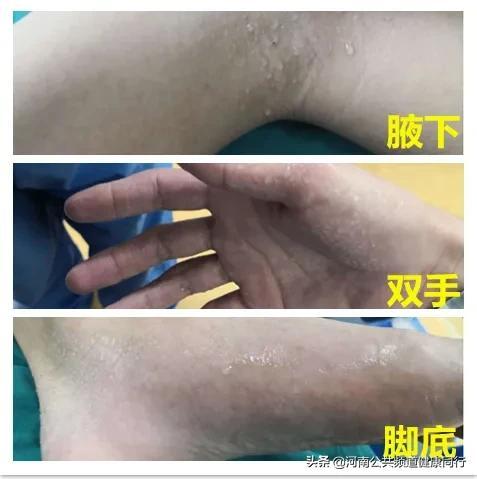 18岁的女孩有一双“水手”，这些烦恼你有吗？