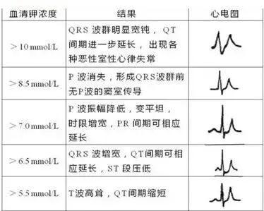 新共识发布！血钾大于5.0 mmol/L为高钾血症！