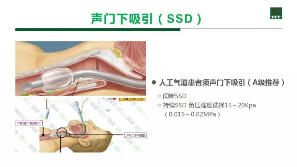 【PPT资源】人工气道管理