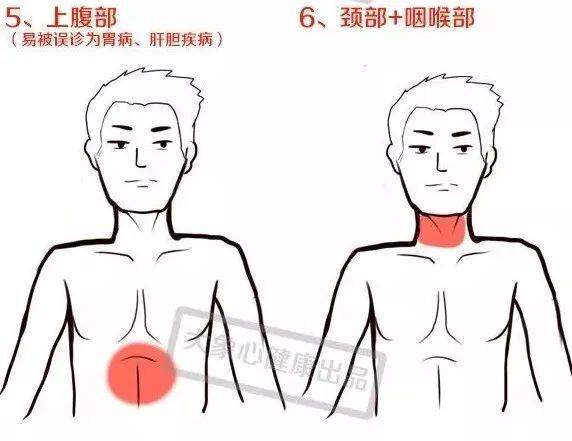 挽救心梗关键3步，从注意这些小症状开始｜1120心梗救治日