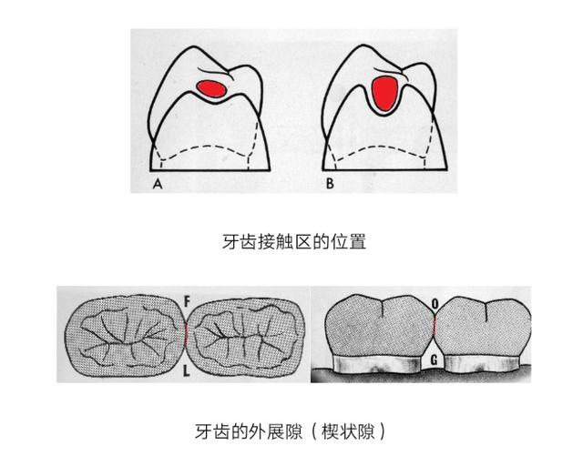 它是打不死的“小强”，怪不得牙病这么难治