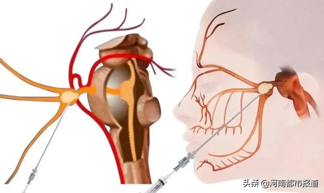 狂扇脸、拔光牙…忍了8年的痛，果然没这么简单