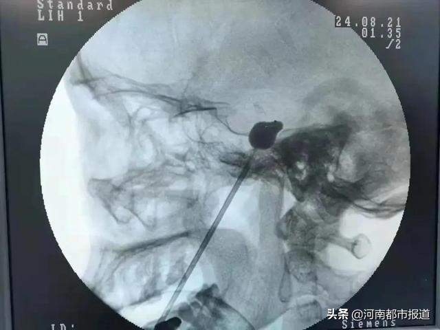 狂扇脸、拔光牙…忍了8年的痛，果然没这么简单