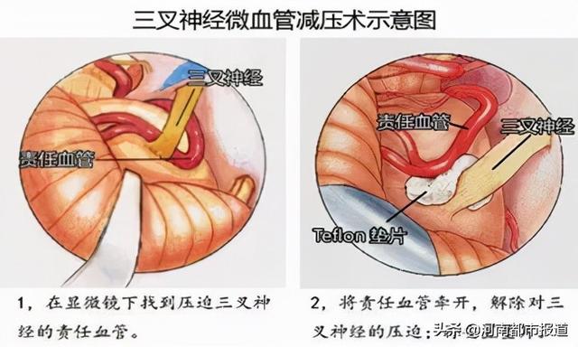 狂扇脸、拔光牙…忍了8年的痛，果然没这么简单