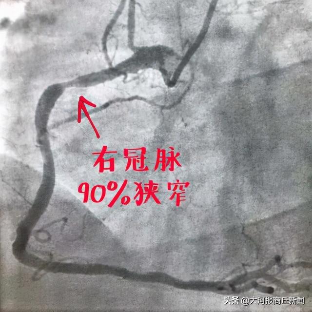 商丘市中医院心病科（心血管内科)二病区：从“心”出发，争做心脏“守护神”