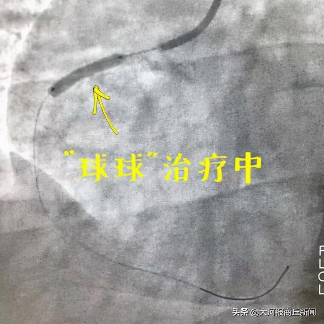 商丘市中医院心病科（心血管内科)二病区：从“心”出发，争做心脏“守护神”