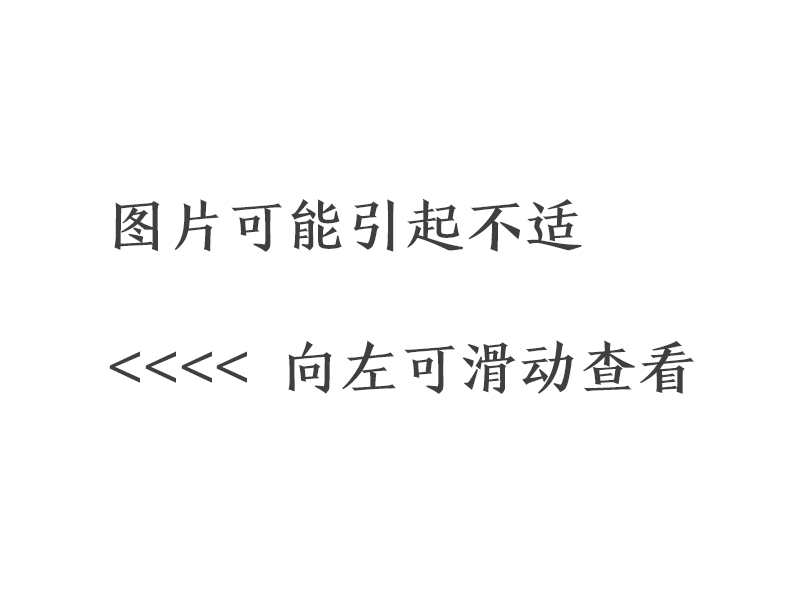 脚趾呈黑色，罕见的黑色胸水，病人死亡，考虑什么病？