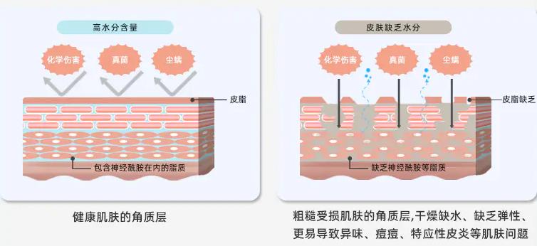 改成 皮肤干燥、紧绷…别乱抓！这样做让你全身水润润～