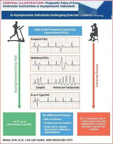 运动后室早，提示风险高！JACC研究
