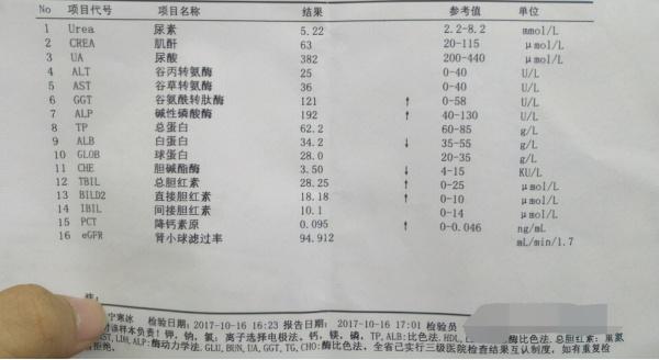 女子每天喝一杯牛奶，确诊肝癌，医生叹息：荒唐，喝一口相当2斤塑料袋