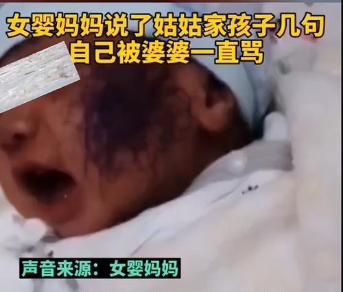 满月女婴脸被亲戚家孩子涂鸦，左脸全被涂黑，亲戚：他只是个孩子