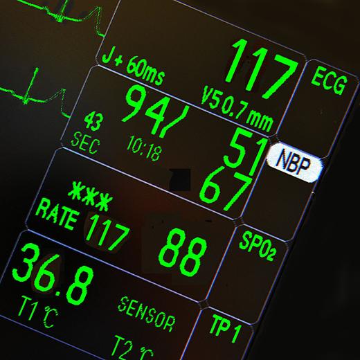 近期高分文献----Anesthesiology Dec2021摘录