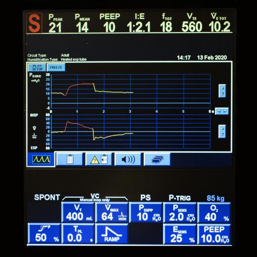 近期高分文献----Anesthesiology Dec2021摘录