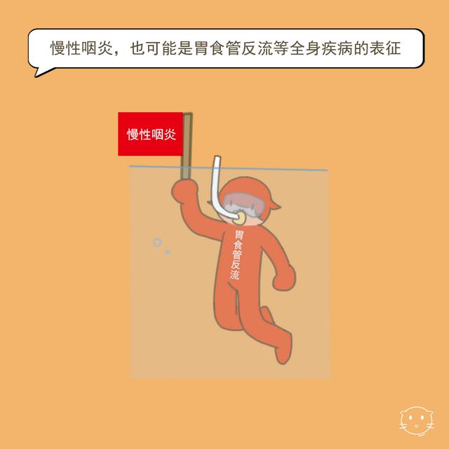 好好的，怎么就得了慢性咽炎？