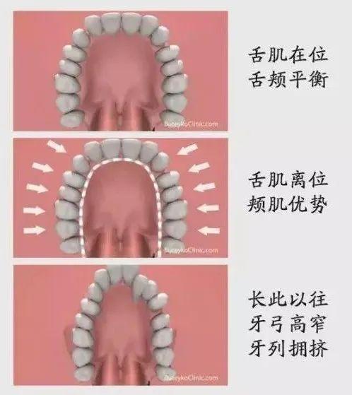 舌头是如何影响你的美貌的？