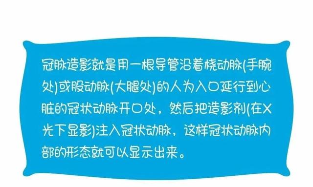 心电图、彩超、冠脉造影有什么区别？这么解释一看就懂