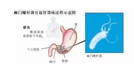 知名男星治病冲上热搜！